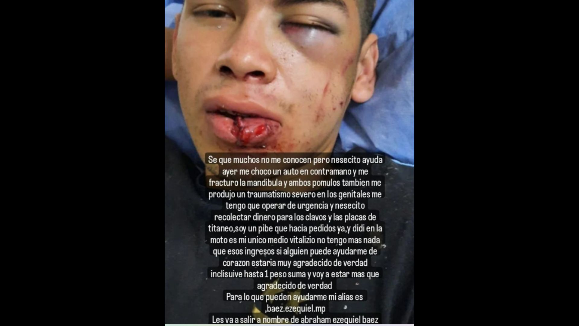 Lo chocó un auto en contramano y debe operarse de urgencia: piden donaciones