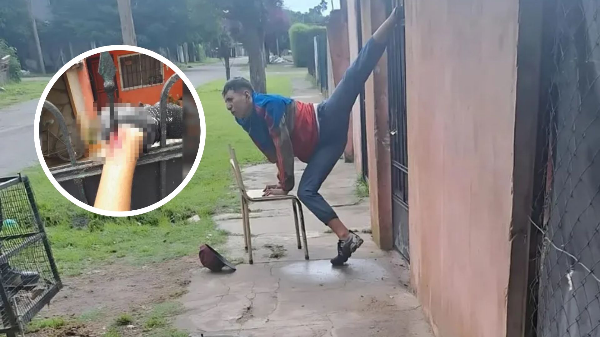 Intentó robar una vivienda y su tobillo izquierdo quedó incrustado en la reja de entrada